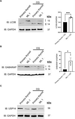 Proliferation and migration of ML1 follicular thyroid cancer cells are inhibited by IU1 targeting USP14: role of proteasome and autophagy flux